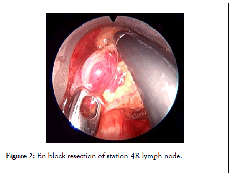 clinical-trials-resection