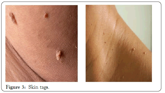 dermatology-research-Skin