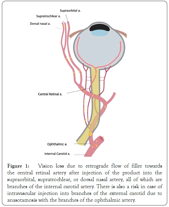 dermatology-research-carotid