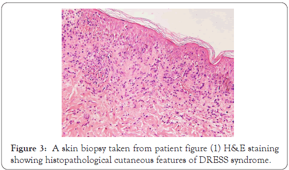 dermatology-research-cutaneous