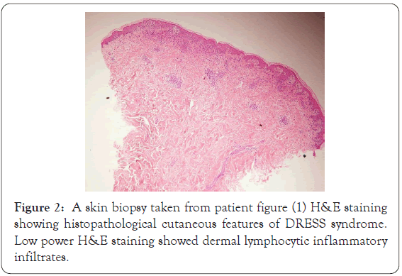 dermatology-research-dermal