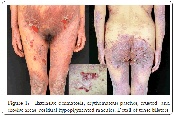 dermatology-research-dermatosis