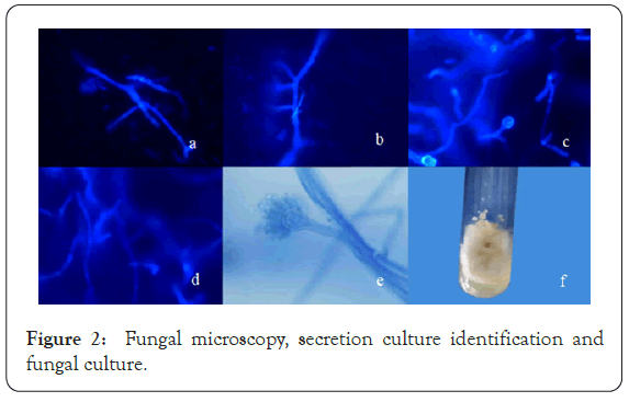 dermatology-research-microscopy