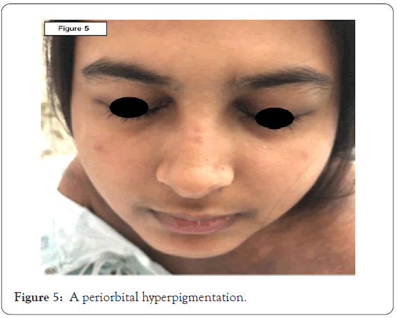 dermatology-research-periorbital