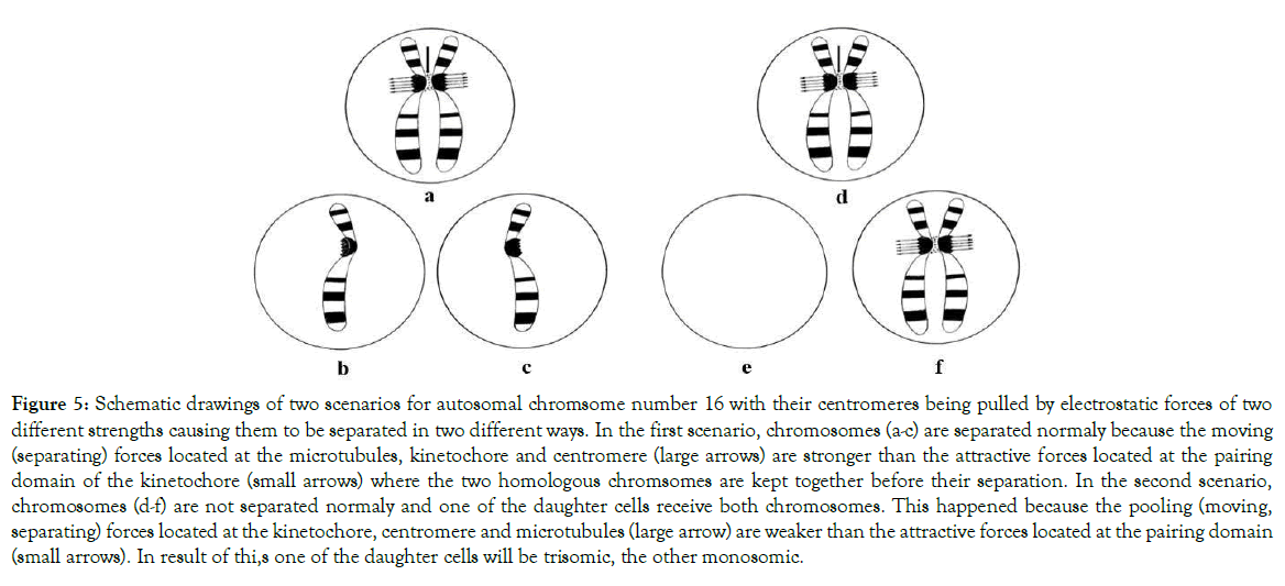 down-syndrome-autosomal-chromsome