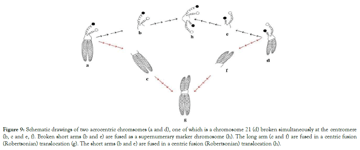 down-syndrome-centric-fusion