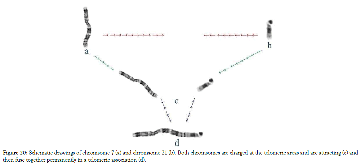 down-syndrome-iso-schematic-drawings