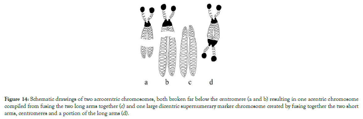 down-syndrome-long-arms