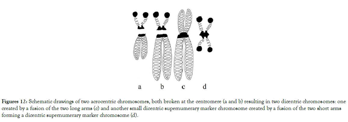 down-syndrome-marker-chromosome