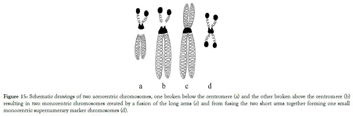 down-syndrome-monocentric-chromosomes