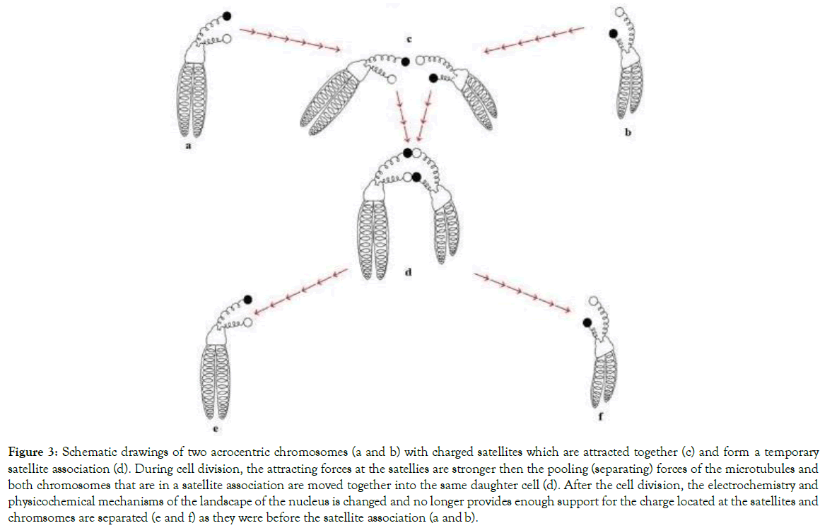 down-syndrome-schematic-drawings