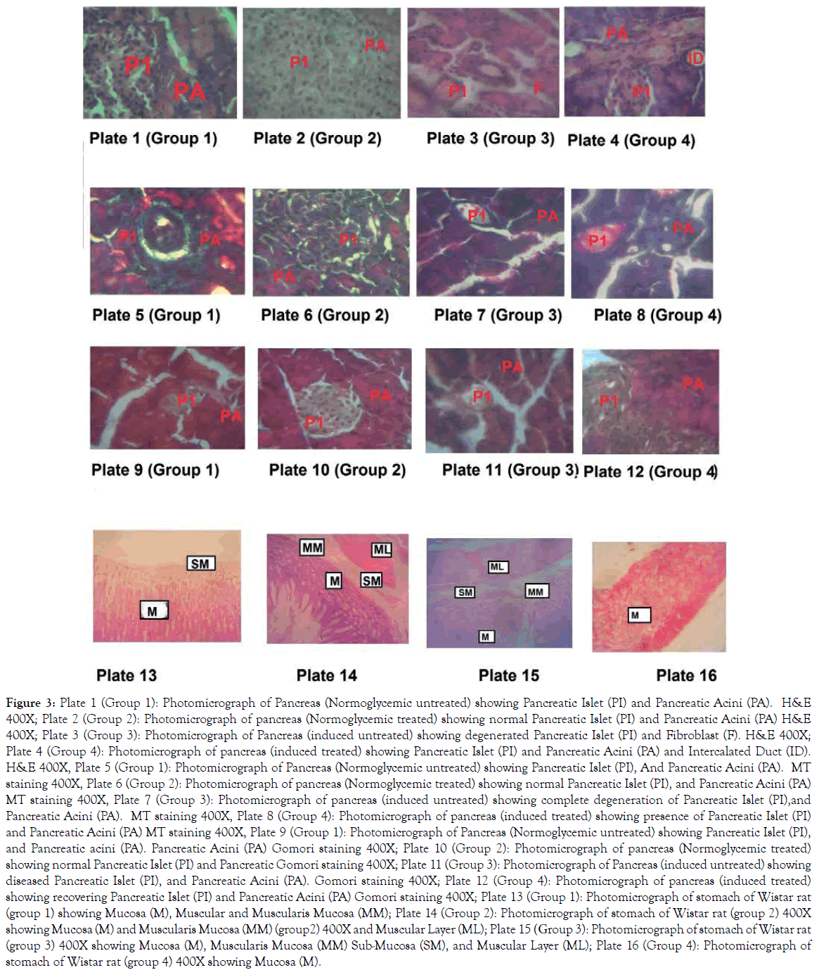 endocrinology-metabolic-syndrome-Photomicrograph