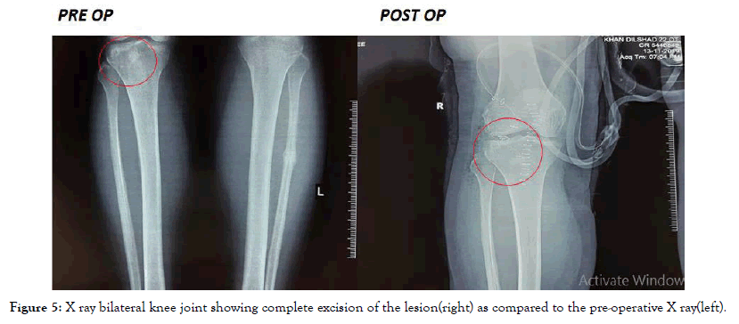 endocrinology-metabolic-syndrome-knee-joint