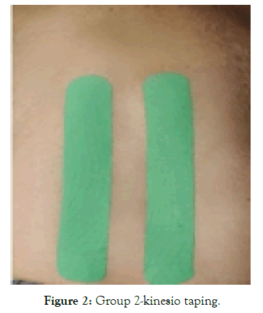 ergonomics-kinesio-taping