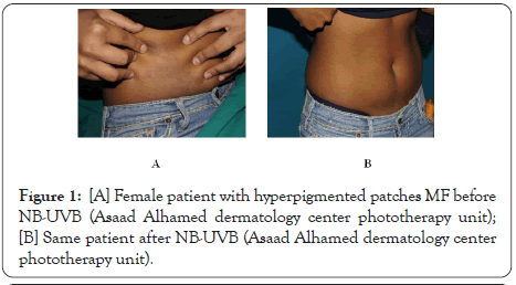 experimental-dermatology-patches