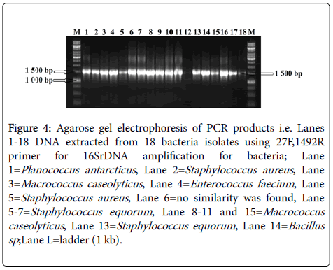 foodmicrobiology-safety-hygiene-Agarose-gel