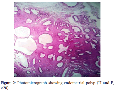 gynecology-obstetrics-Photomicrograph