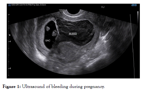 gynecology-obstetrics-Ultrasound