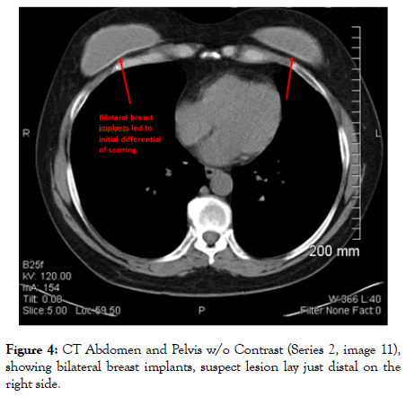 gynecology-obstetrics-bilateral-breast