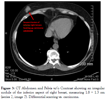 gynecology-obstetrics-premature-Progesteron