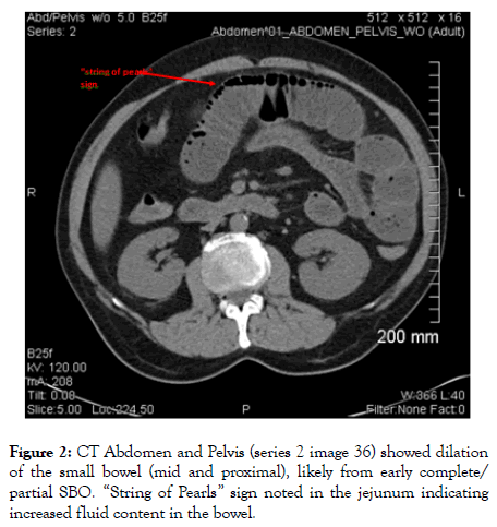 gynecology-obstetrics-dilation