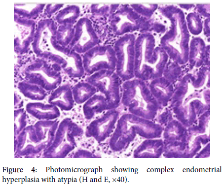 gynecology-obstetrics-hyperplasia