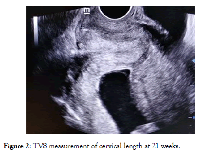 gynecology-obstetrics-measurement