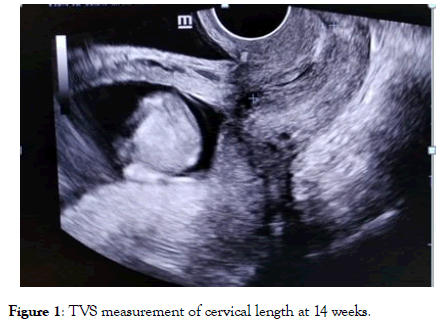 gynecology-obstetrics-oxidative-stress