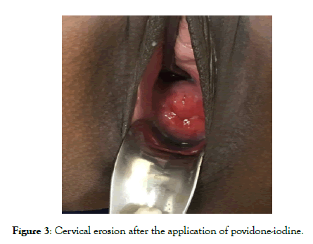 gynecology-obstetrics-povidone-iodine