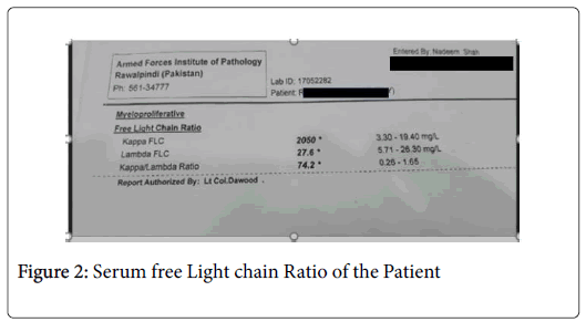 haematology-thromboembolic-Light-chain-Ratio