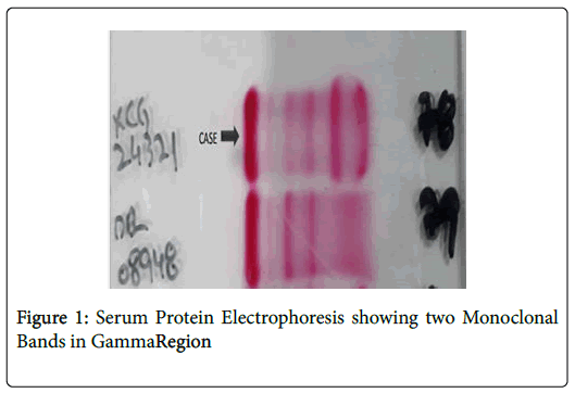 haematology-thromboembolic-Protein