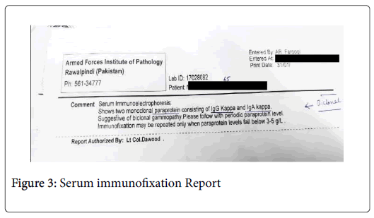 teksten pariteit Verward zijn Double Gammopathy of Undetermined Significance-A First Case Report from  Pakistan