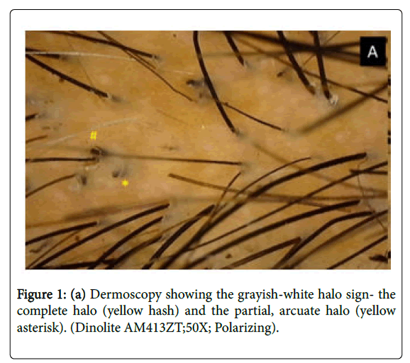 Drawing shows how hair follicle was divided into three parts  Download  Scientific Diagram