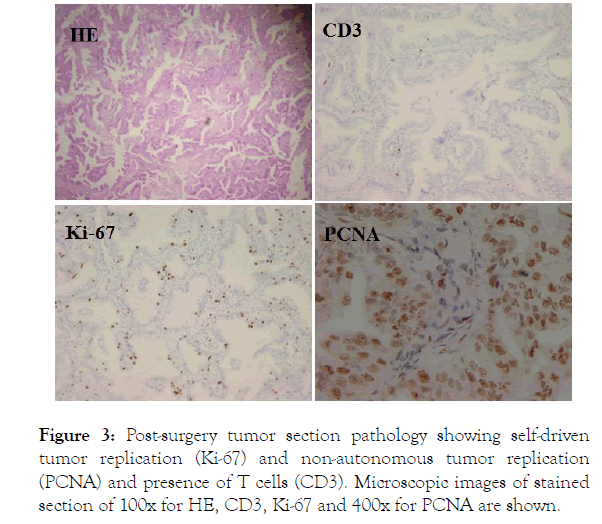 immunome-research-pathology