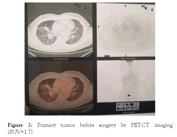 immunome-research-surgery