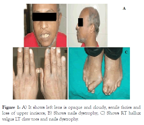 internal-medicine-opaque-senile