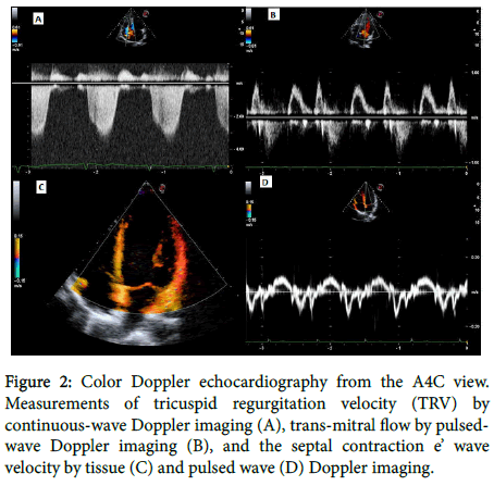 lupus-Color-Doppler