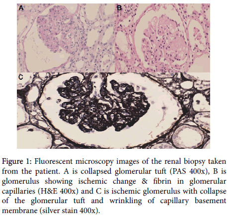 lupus-Fluorescent-microscopy