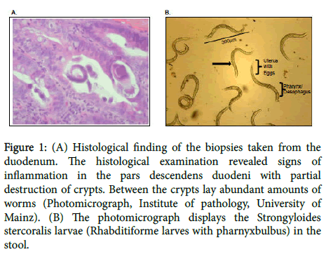 lupus-histological-examination