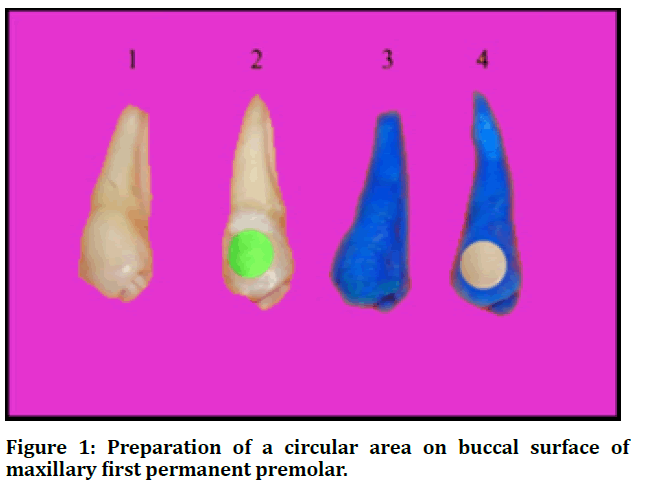 medical-dental-buccal-surface