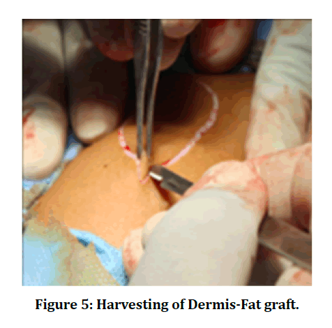 medical-dental-dermis-fat