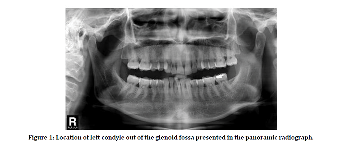 medical-dental-glenoid-fossa