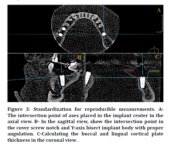 medical-dental-implant-center