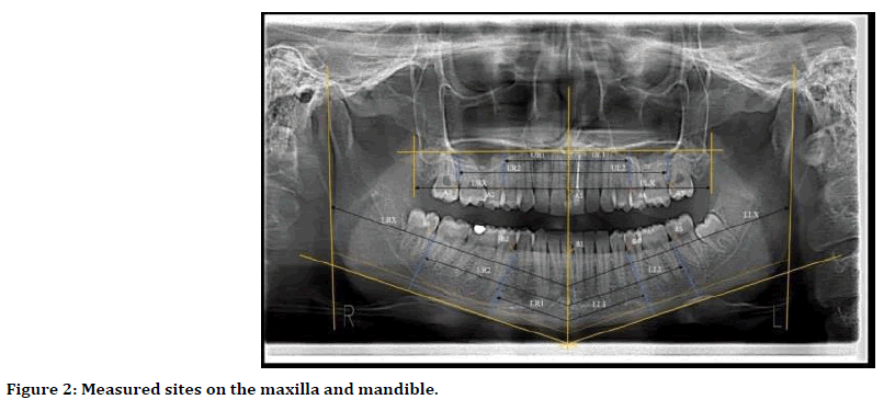 medical-dental-maxilla-mandible