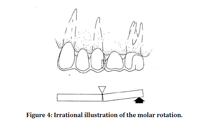 medical-dental-molar-rotation