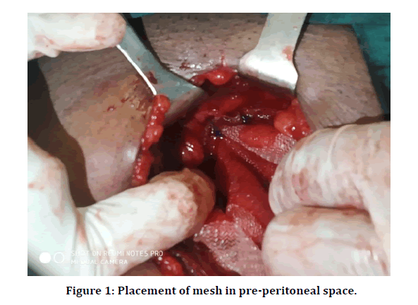 medical-dental-peritoneal-space