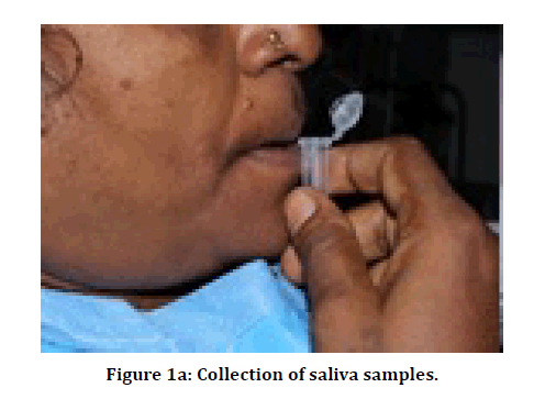 medical-dental-saliva-samples