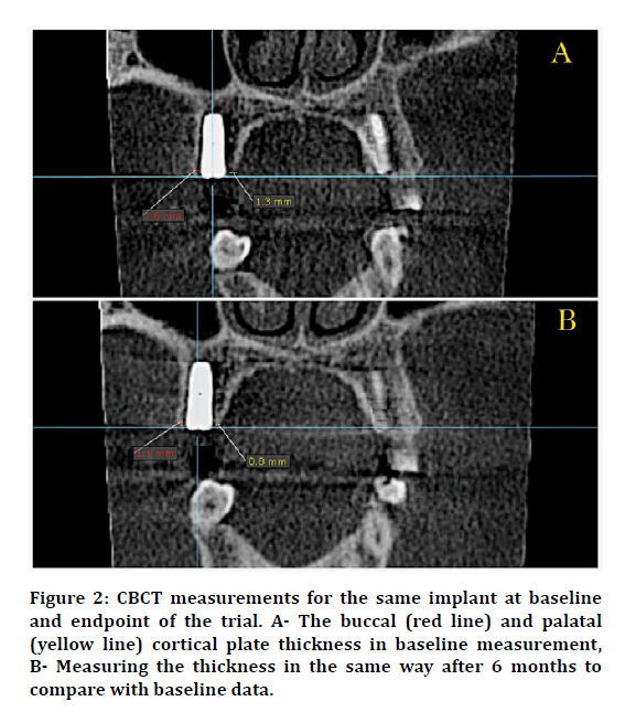 medical-dental-same-implant