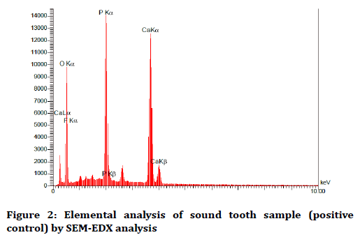 medical-dental-science-Elemental-analysis