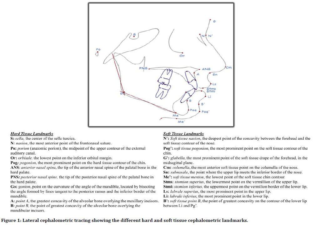 medical-dental-science-Lateral-cephalometric-tracing